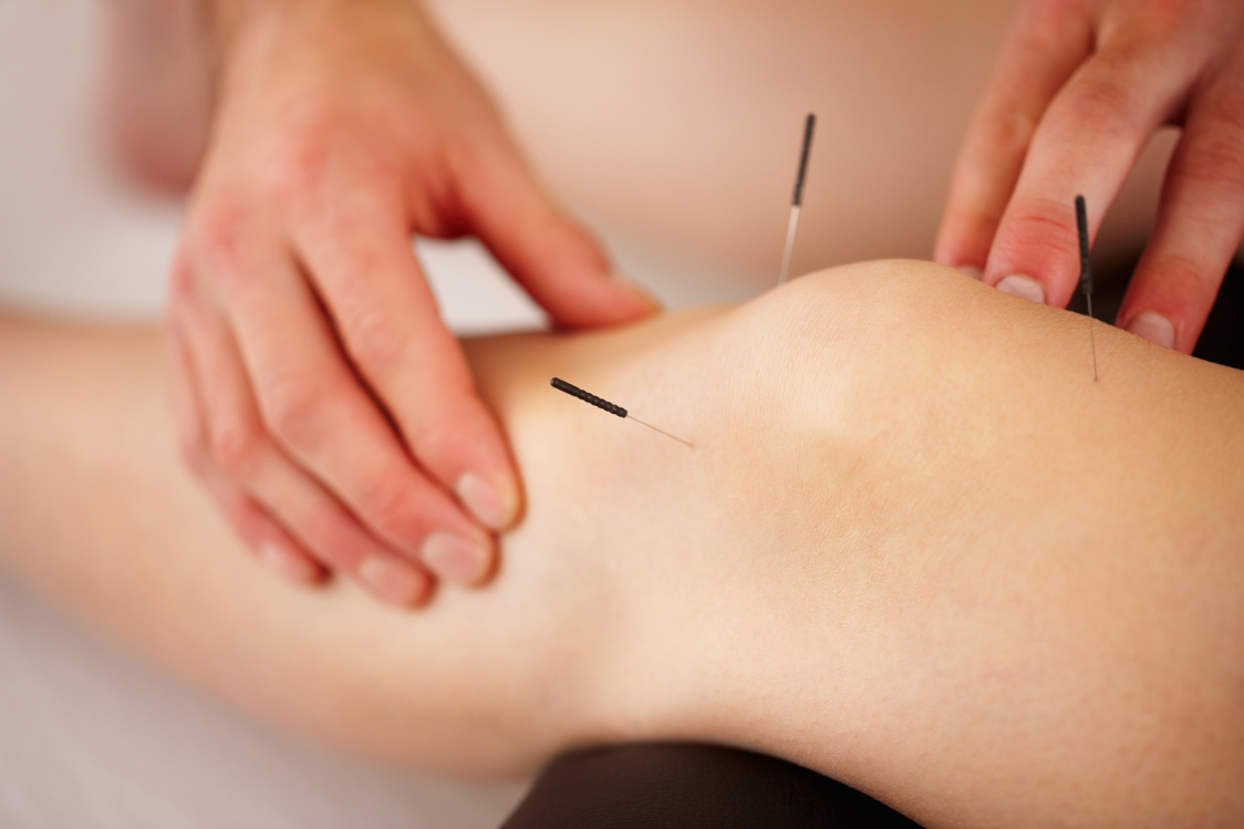 Acupuncture is an old healing modality that heal body, mind and spirit and old traumas 